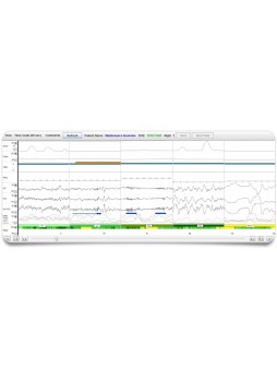 Монитор контроля сна с EEG Sleep Profiler™