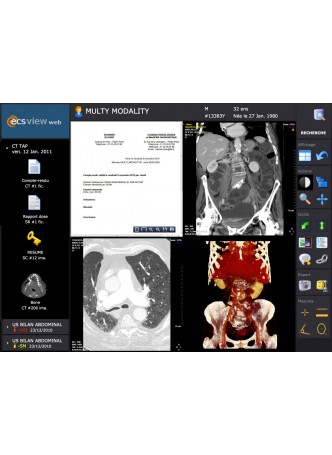 PACS с данными из интернета ECS Imaging оптом