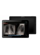 Планшетный медицинский ПК Quad Core DT-130 (DICOM)
