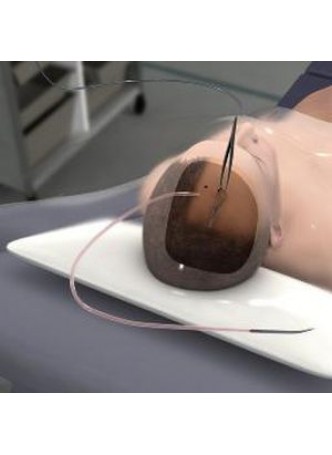 Приложение iOS для нейрохирургии External Ventricular Drain оптом