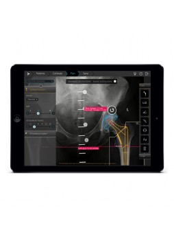 Приложение iOS для ортопедической хирургии TraumaCad® Mobile 2.0