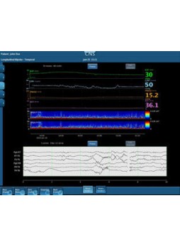 Программное обеспечение для анализа CNS Monitor