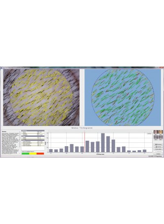 Программное обеспечение дерматология TrichoScan HD оптом