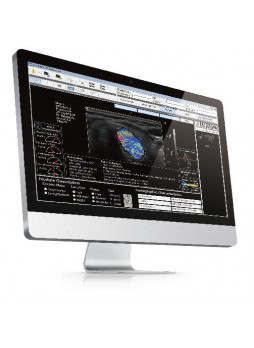 Программное обеспечение для эхографии AmCAD-UT®