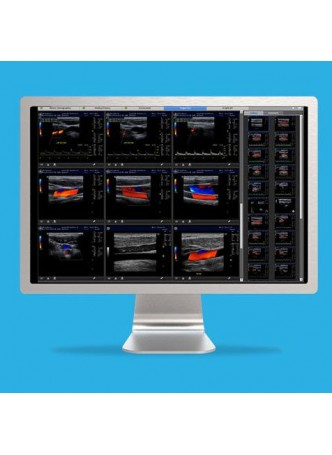 Программное обеспечение для эхографии ViewPoint оптом