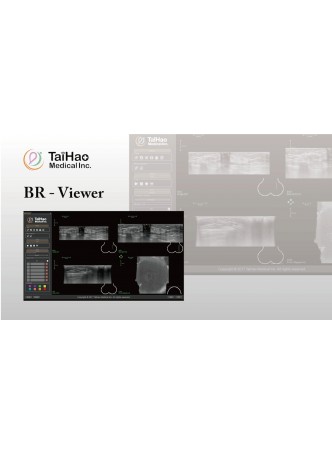 Программное обеспечение для эхографии BR-Viewer for ABUS