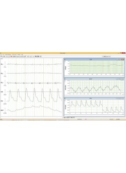 Программное обеспечение для ЭКГ Recorder