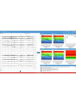 Программное обеспечение для ЭКГ NeuroCenter®