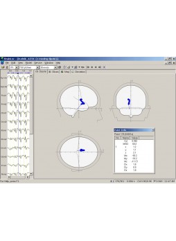 Программное обеспечение для ЭКГ BrainLoc 6.0