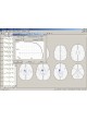 Программное обеспечение для ЭКГ BrainLoc 6.0