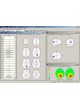 Программное обеспечение для ЭКГ BrainLoc 6.0