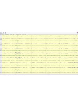 Программное обеспечение для ЭКГ Neuron-Spectrum-Viewer