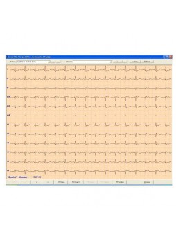 Программное обеспечение для электрокардиографии CardioTEKA