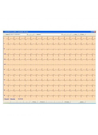 Программное обеспечение для электрокардиографии CardioTEKA оптом