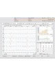 Программное обеспечение для диагностики custo diagnostic оптом