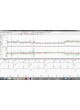 Программное обеспечение для электрокардиографии CardioExplorer оптом