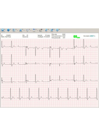 Программное обеспечение для электрокардиографии UMED® euro ecg оптом