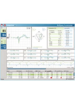 Программное обеспечение для электрокардиографии PADSY-ECG