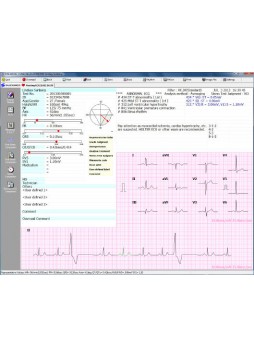 Программное обеспечение для электрокардиографии CVS-03