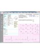Программное обеспечение для электрокардиографии CVS-03 оптом