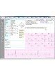 Программное обеспечение для электрокардиографии CVS-03