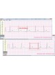 Программное обеспечение для электрокардиографии CVS-03