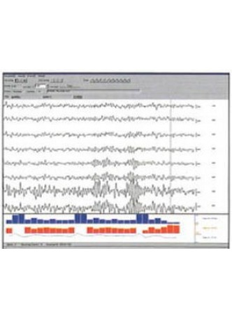 Программное обеспечение для EMG SleepSign™