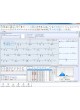 Программное обеспечение для EMG Neuron-Spectrum-EMG