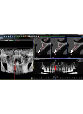 Программное обеспечение для медицинских снимков 3Diagnosys®