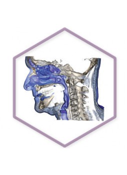 Программное обеспечение для медицинских снимков 3Diagnosys®