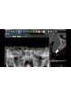 Программное обеспечение для медицинских снимков 3Diagnosys®