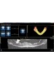 Программное обеспечение для медицинских снимков 3Diagnosys®