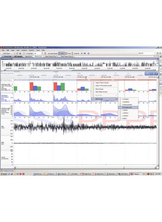 Программное обеспечение для нейрофизиологического стимулирования NeuroScore