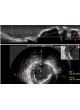 Программное обеспечение для исследования сосудов CAAS IVUS OCT оптом