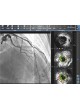Программное обеспечение для исследования сосудов CAAS IVUS OCT оптом