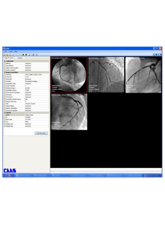 Программное обеспечение для медицинских снимков CAAS QCA оптом