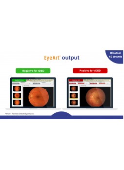 Программное обеспечение для офтальмологии EyeArt ®