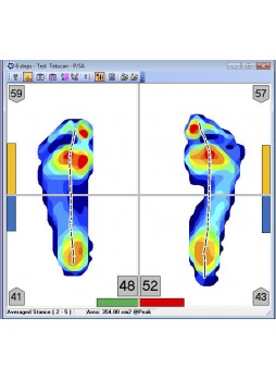 Программное обеспечение для лечения заболеваний стоп FootMat™ Researchers
