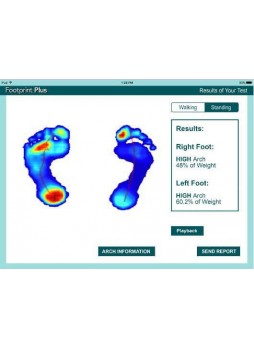 Программное обеспечение для лечения заболеваний стоп Footprint Plus™