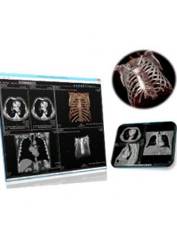 Программное обеспечение для рентгенологии VisionHM MPR Radiology