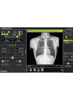 Программное обеспечение для медицинских снимков ERACLE