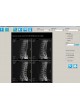 Программное обеспечение для медицинских снимков iQ-VIEW BASIC оптом