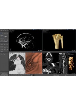 Программное обеспечение для визуализации 3D Myrian® Expert