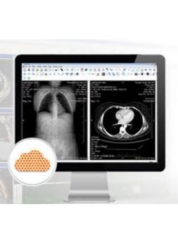 Программное обеспечение для медицинских снимков eFilm Workstation®