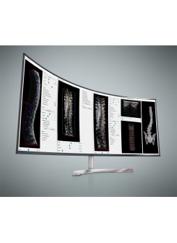 Программное обеспечение для рентгенологии Scoliostudio®