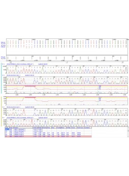 Программное обеспечение для последовательности оснований в ДНК Mutation Surveyor®