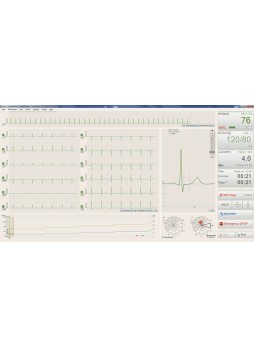 Программное обеспечение для нагрузочного тестирования BTL CardioPoint-Ergo E600