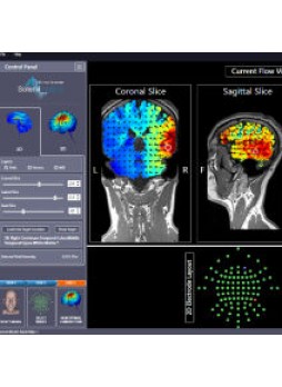Программное обеспечение для нейрофизиологического стимулирования HD-Targets™