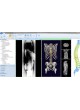 Клиническое программное обеспечение mediCAD 3D Spine оптом