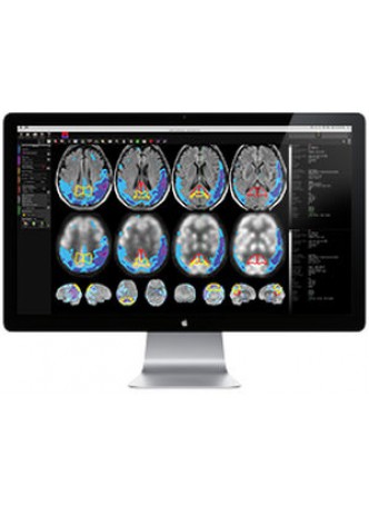 Программное обеспечение для обработки изображений головного мозга mim neuro™ оптом